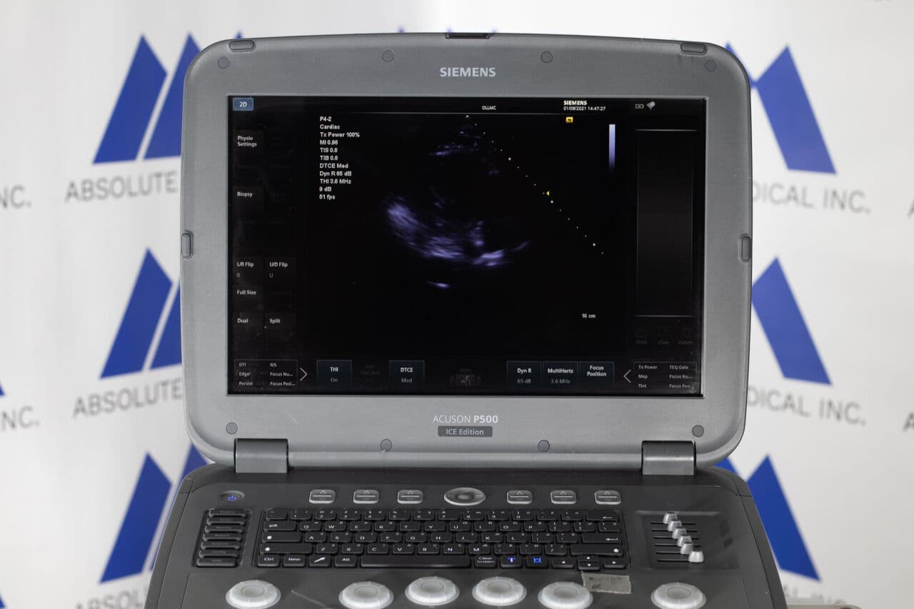 Siemens Acuson P500 Frosk Portable Ultrasound System thumbnail 7