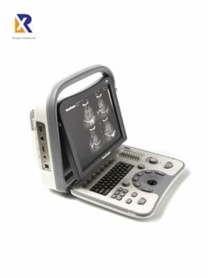 SonoScape A6 General Ultrasound System image 1