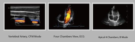 General Imaging Ultrasound System — Chison i3 thumbnail 5