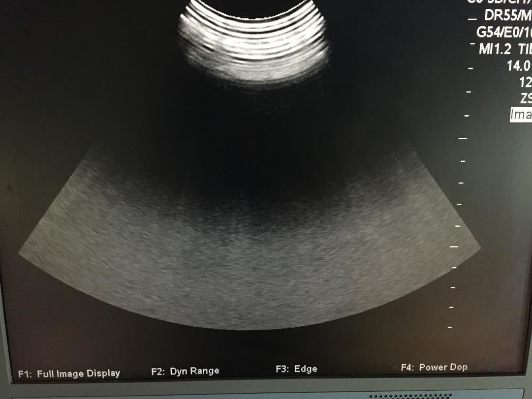 Zonare Z.One Ultrasound System thumbnail 6