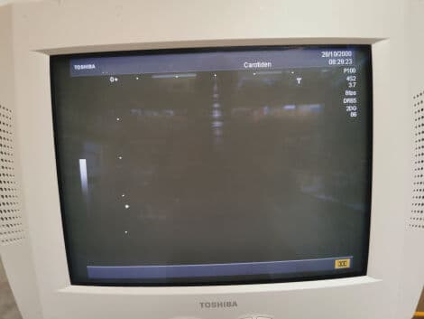 Toshiba PSM-25AT Cardiac Ultrasound Transducer thumbnail 3
