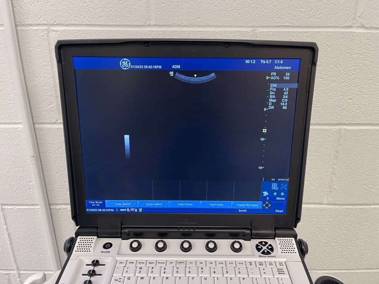 GE Healthcare Nextgen Logiq-e Portable Ultrasound System thumbnail 2