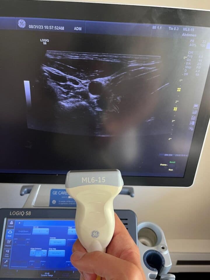 GE Logiq S8 XDclear Ultrasound System for Clinical Imaging thumbnail 3