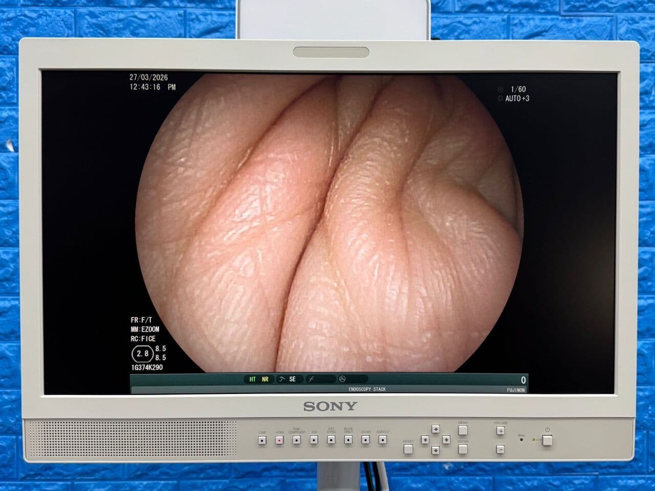 For Sale FUJINON Scope Model: EG-530FP Gastroscope Gastroscope thumbnail 2