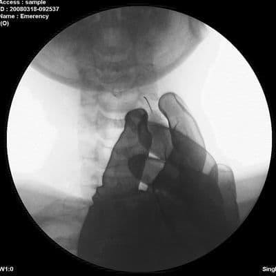 Genoray New Zen 7000 Mobile C-Arm Fluoroscopy System thumbnail 5