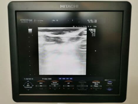 Hitachi Aloka F-37 Ultrasound System with UST-9123, UST-568, and UST-9124 Probes thumbnail 6
