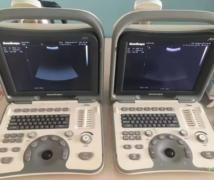 SonoScape A5 Portable Ultrasound Scanner with Convex Probe thumbnail 2