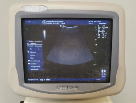 GE Logiq 7 Cardiac Ultrasound System thumbnail 7