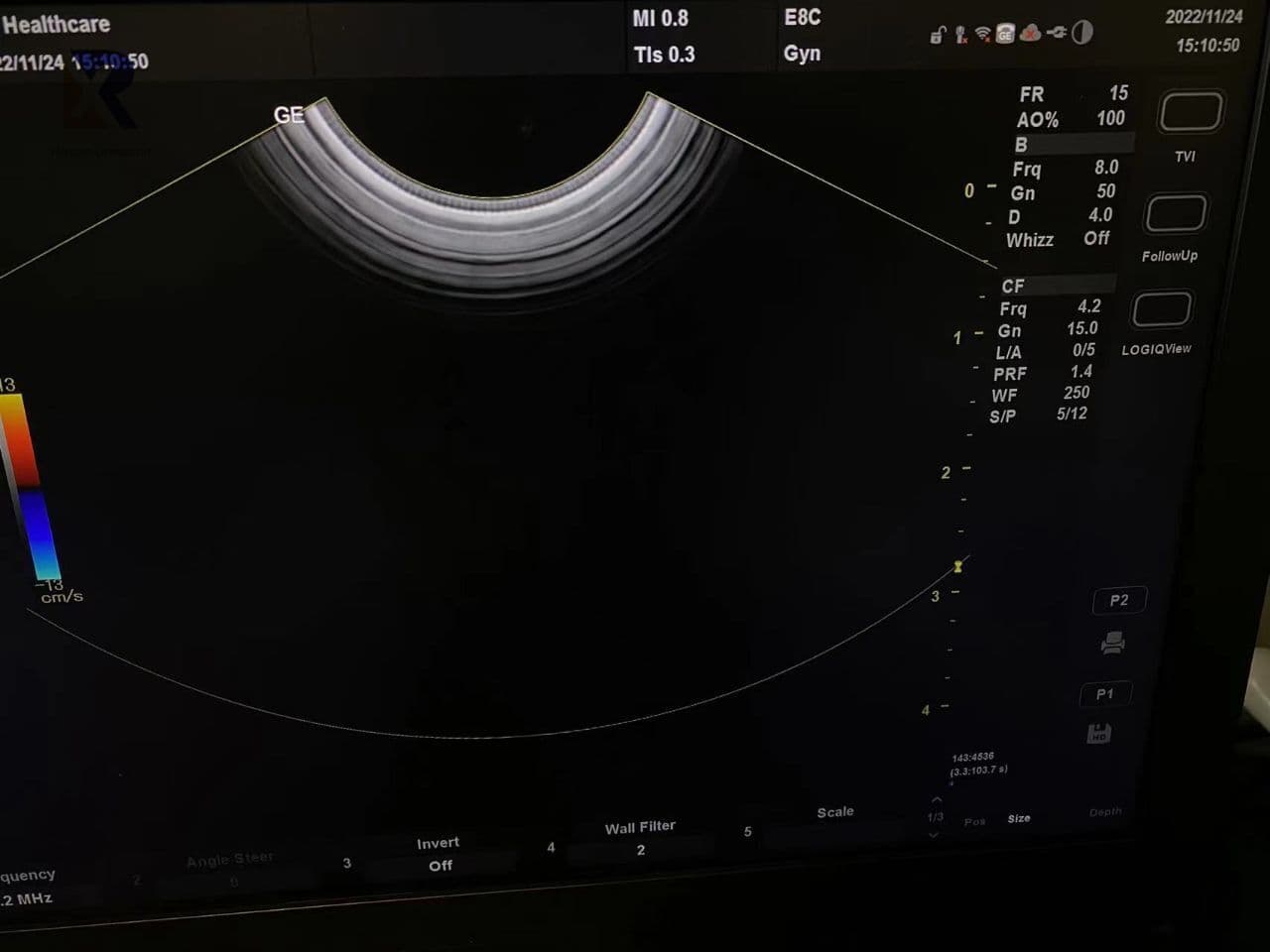 GE E8C-RS Endocavity Convex Ultrasound Transducer thumbnail 4