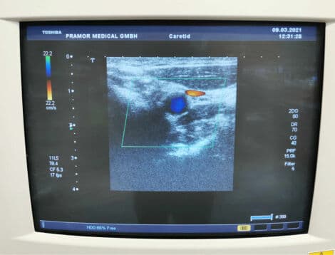 Toshiba PLT-704AT Linear Ultrasound Transducer thumbnail 8