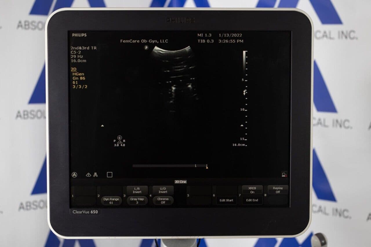 Philips ClearVue 650 OB/GYN Ultrasound System thumbnail 5