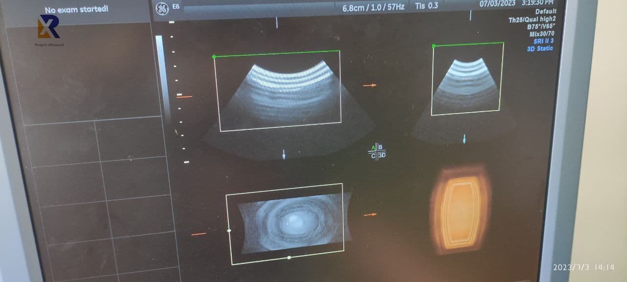 GE RAB2-5-D 3D/4D Curved Array Ultrasound Transducer thumbnail 3