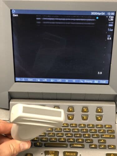 SonoSite TITAN Portable Ultrasound System with L38 Linear Array Probe thumbnail 6