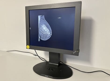 Totoku CCL 182 Diagnostic X-Ray Monitor thumbnail 2