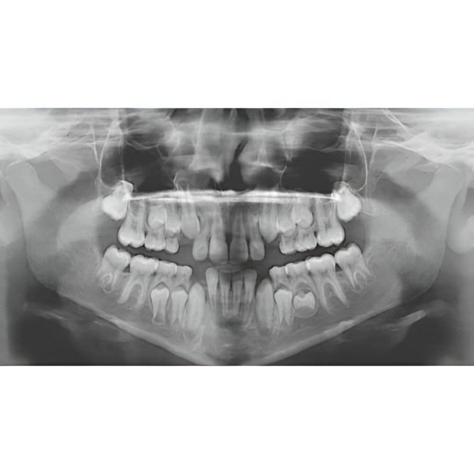 Carestream CS9000 Pan/CBCT 3D Dental X-Ray System thumbnail 10