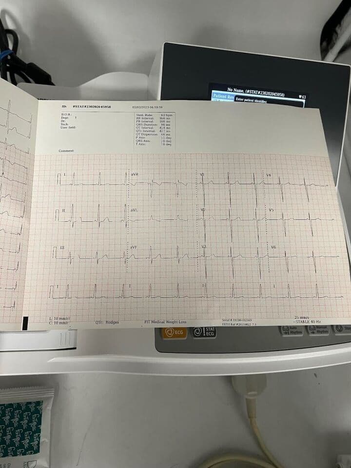 Burdick 8300 EKG Machine thumbnail 3