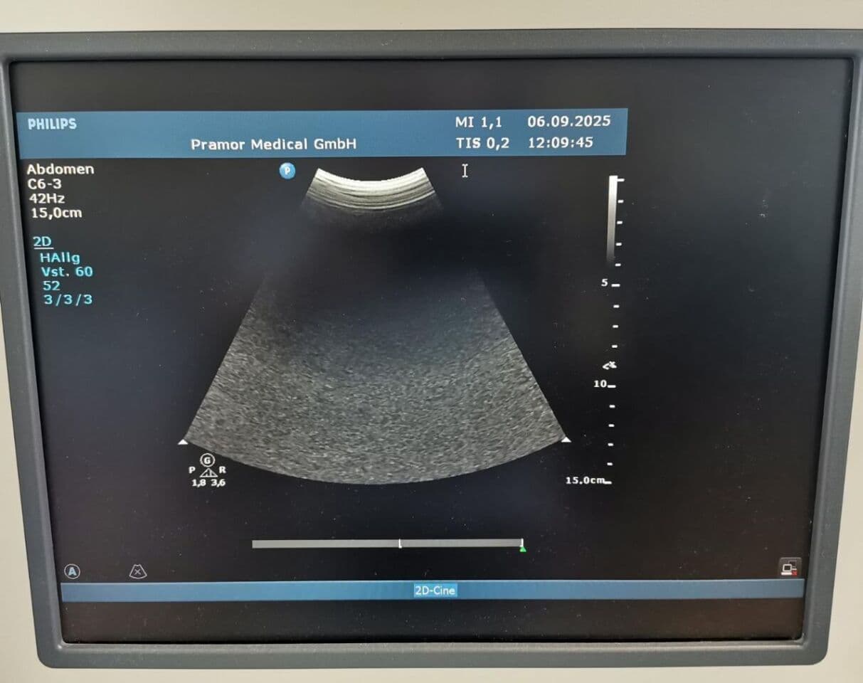 Abdominal and OB/GYN Ultrasound Probe — Philips C6-3 Convex Transducer thumbnail 4