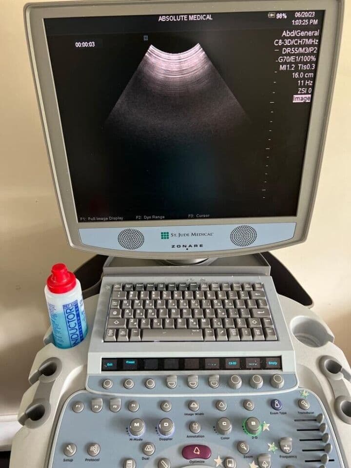 ZONARE C8-33D 3D Ultrasound Transducer image 1