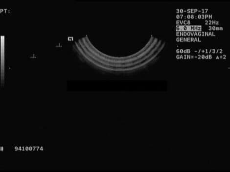Siemens Acuson EVC8 Transvaginal Ultrasound Transducer thumbnail 3