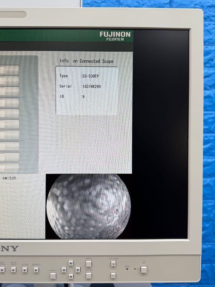 For Sale FUJINON Scope Model: EG-530FP Gastroscope Gastroscope thumbnail 5