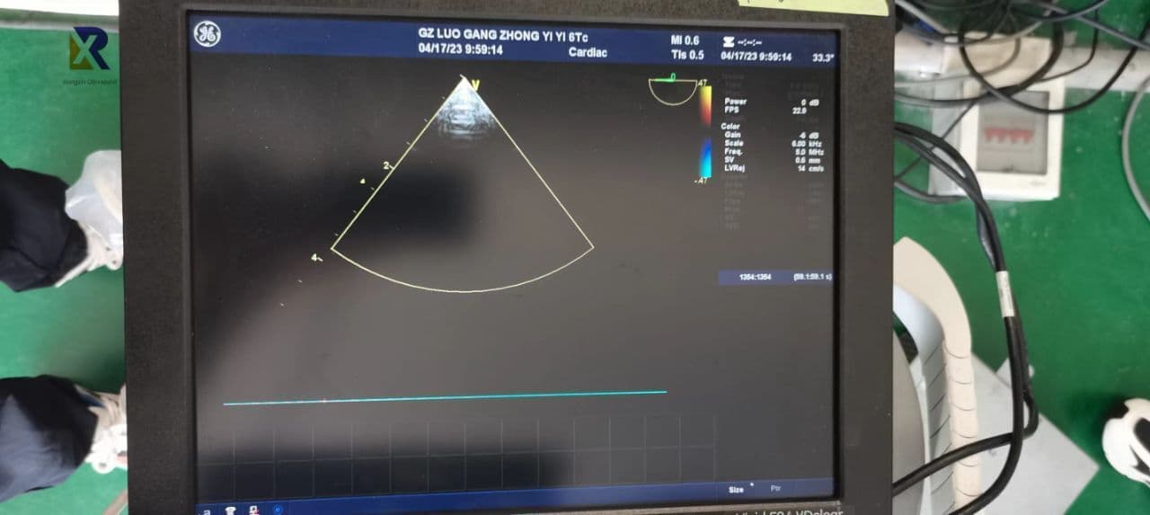 GE 6TC TEE Phased Array Ultrasound Transducer thumbnail 4