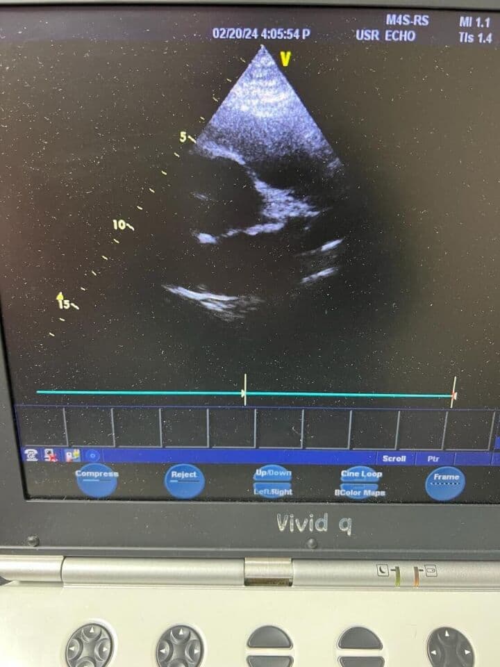 GE Vivid Q Portable Echocardiography Ultrasound System thumbnail 8