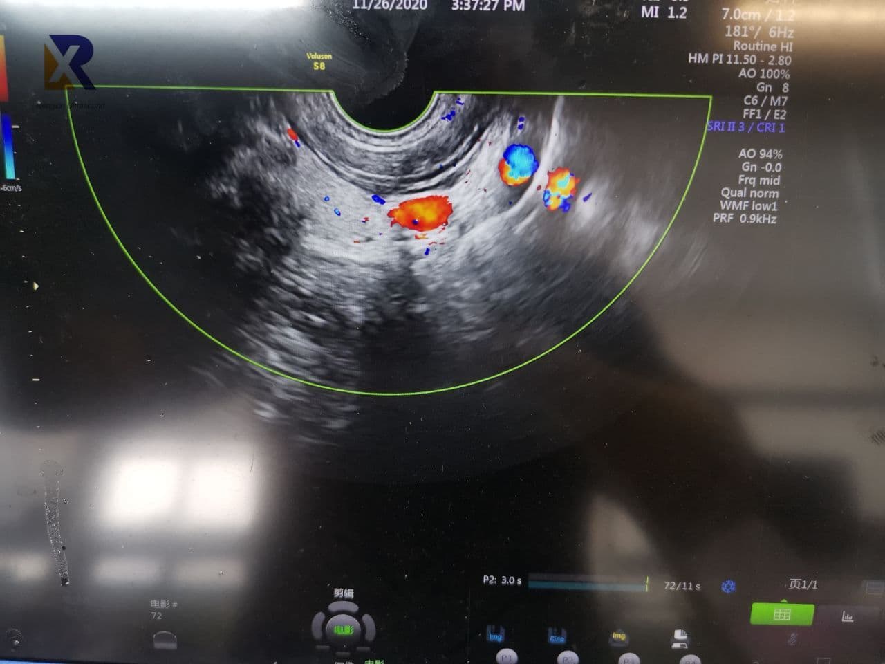 GE IC9-RS Intra-Cavity Ultrasound Transducer thumbnail 3