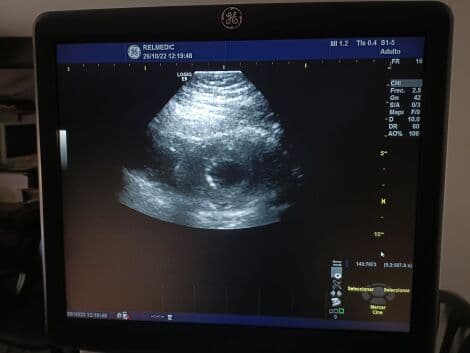 GE S1-5-D Sector Ultrasound Transducer for Logiq E9 & S8 Systems thumbnail 4