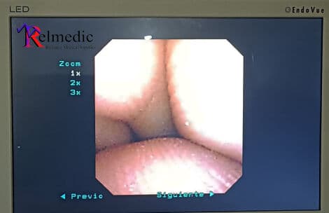 Karl Storz 11278V Video Ureteroscope thumbnail 3