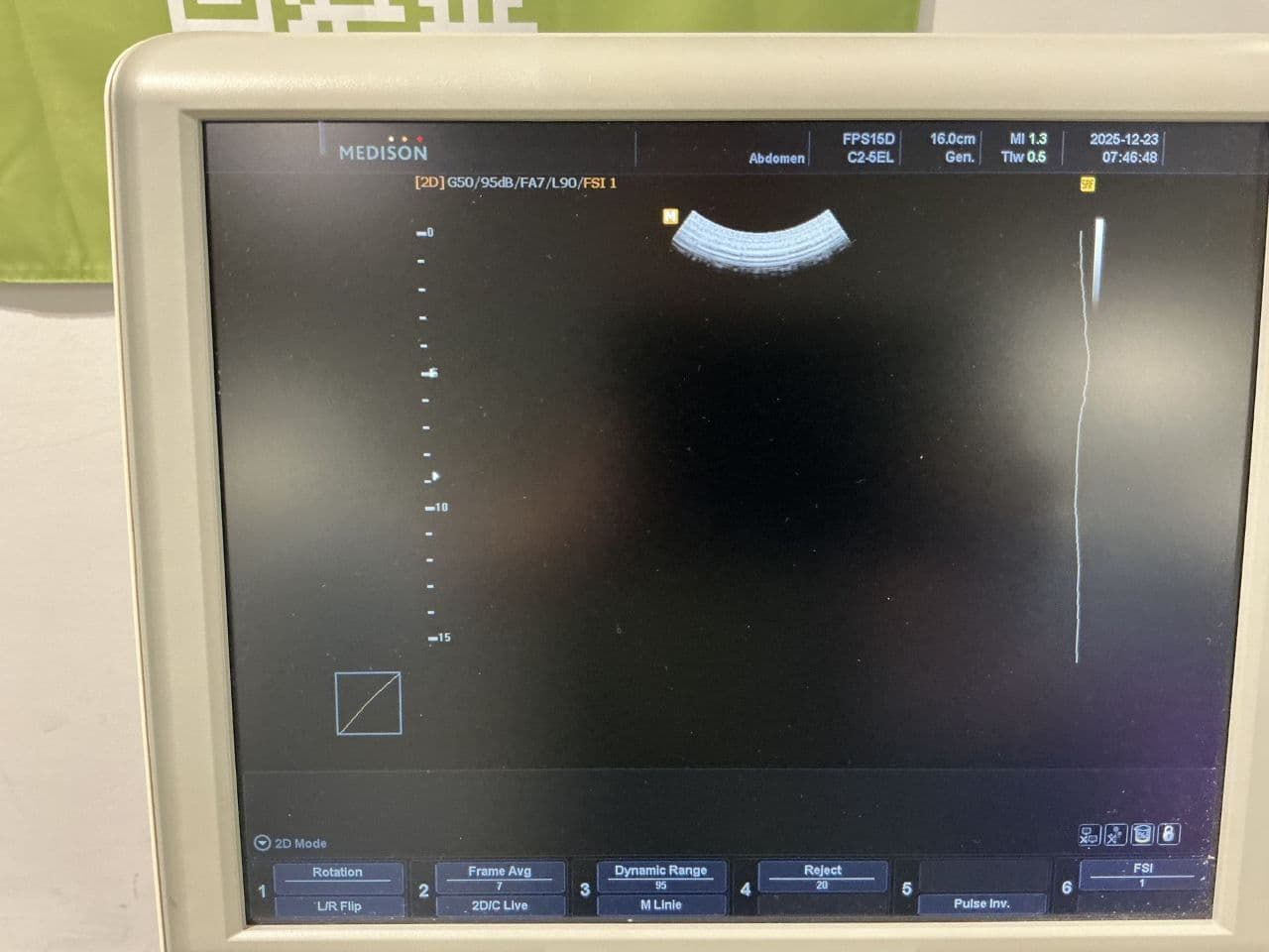 For Sale SAMSUNG Accuvix V10 Cardiac - Vascular Ultrasound thumbnail 3