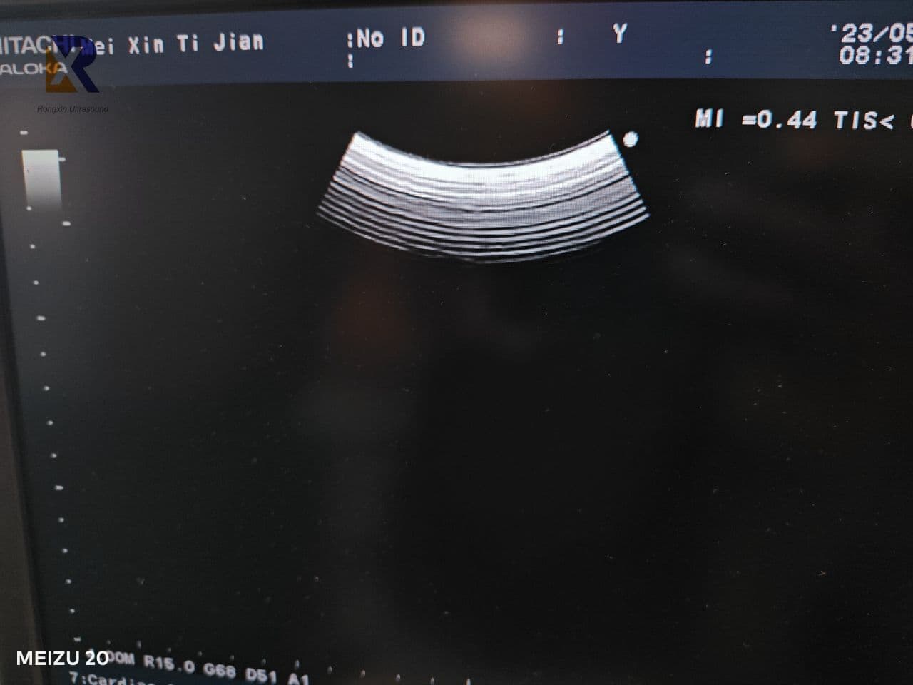 Aloka UST-9123 Convex Array Ultrasound Transducer thumbnail 4