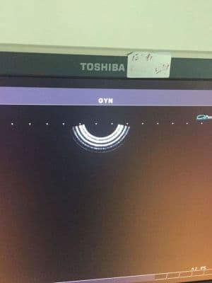 AKICARE PVT-661VT Endocavity Ultrasound Transducer for Toshiba thumbnail 2