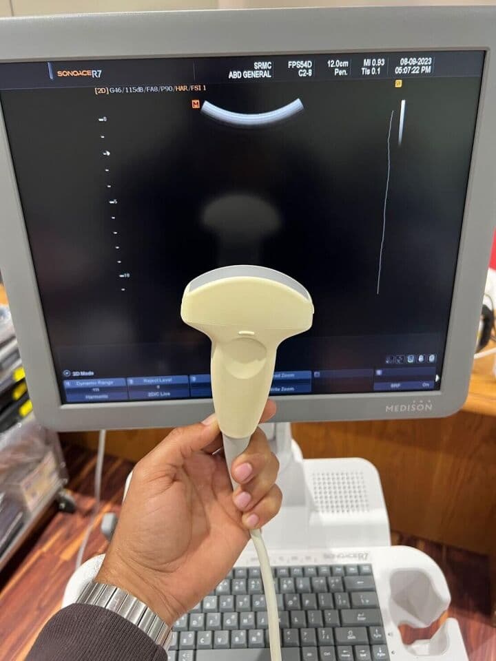 Samsung SonoAce 3D/4D OB/GYN Ultrasound System thumbnail 4