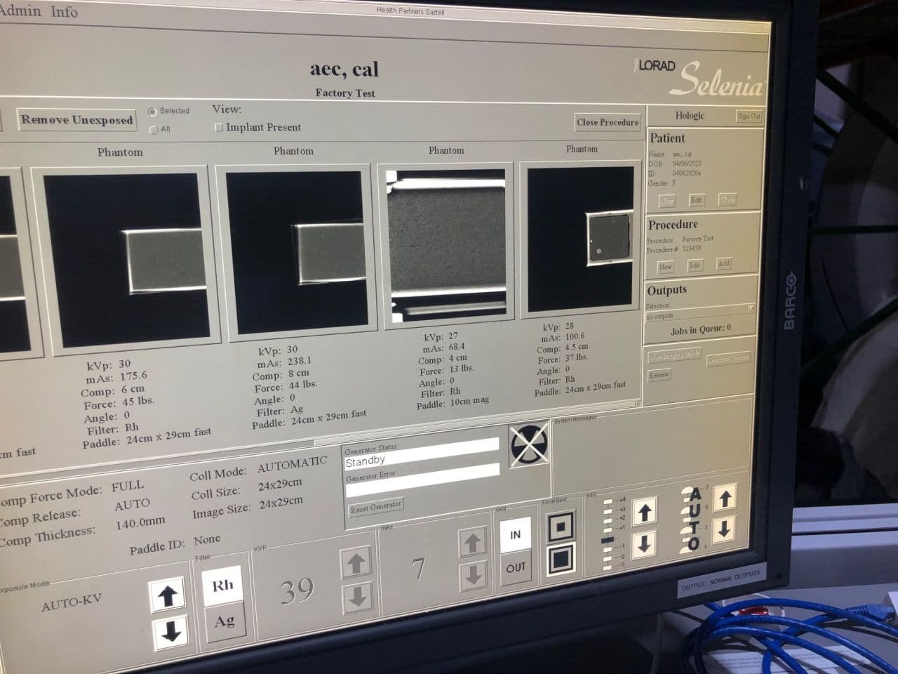 Hologic Selenia Full-Field Digital Mammography System thumbnail 5