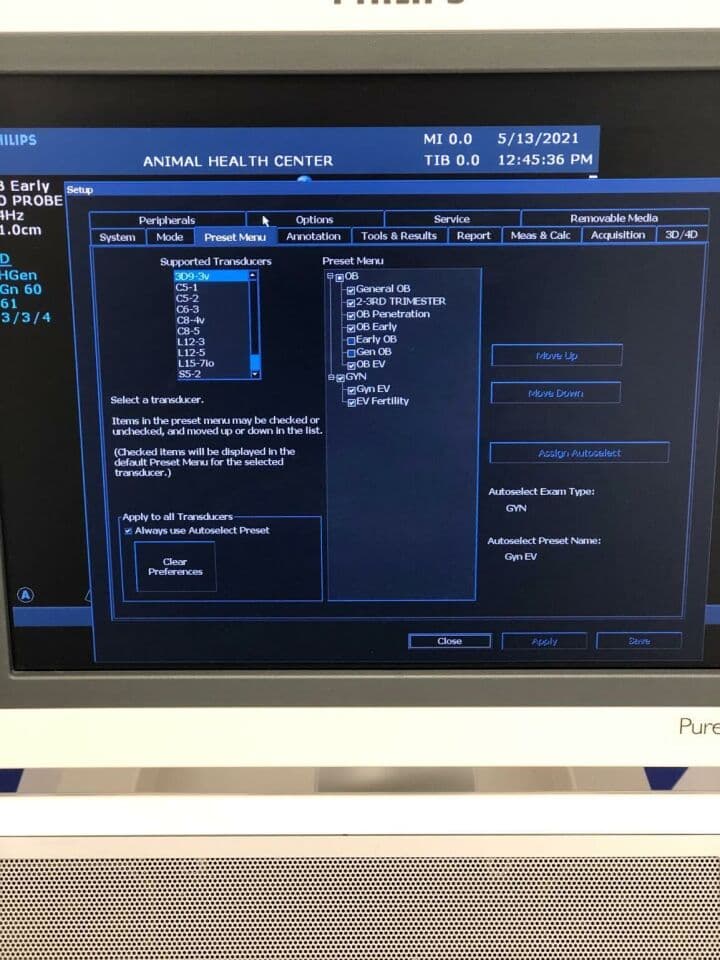 Philips HD15 Diagnostic Ultrasound System thumbnail 5