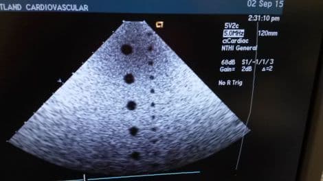 Acuson 5v2c Cardiac Ultrasound Transducer for Sequoia Systems thumbnail 3