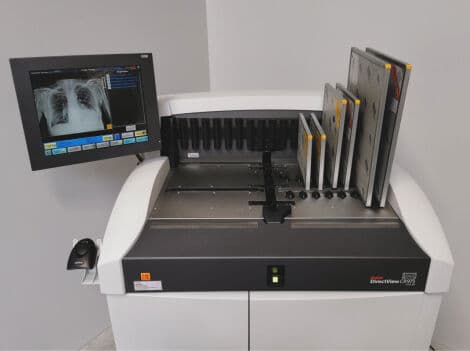 Kodak DirectView CR 975 Computed Radiography System thumbnail 3
