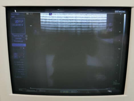 Siemens VFX 9-4 Linear Array Ultrasound Transducer thumbnail 2
