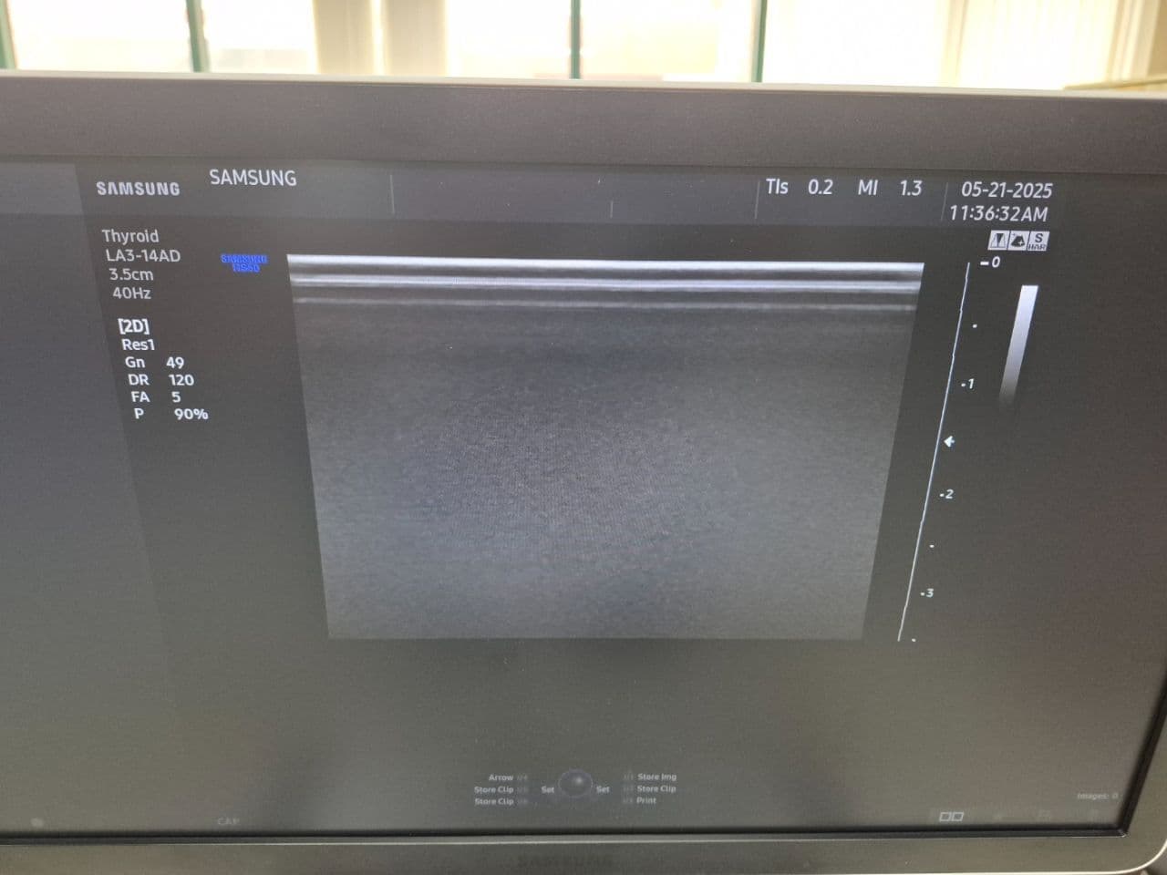 Samsung LA3-14AD Linear Array Ultrasound Transducer thumbnail 5