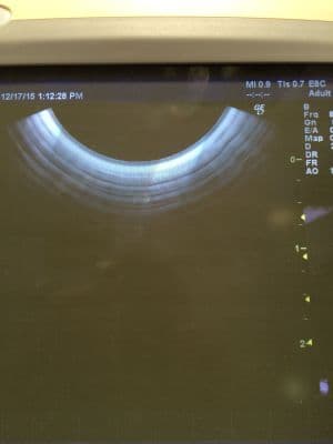 GE E8C Transvaginal Ultrasound Transducer Probe thumbnail 3