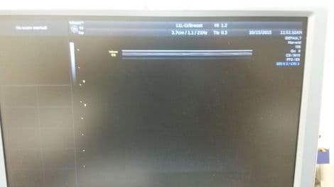 GE 11L-D Linear Ultrasound Transducer thumbnail 3