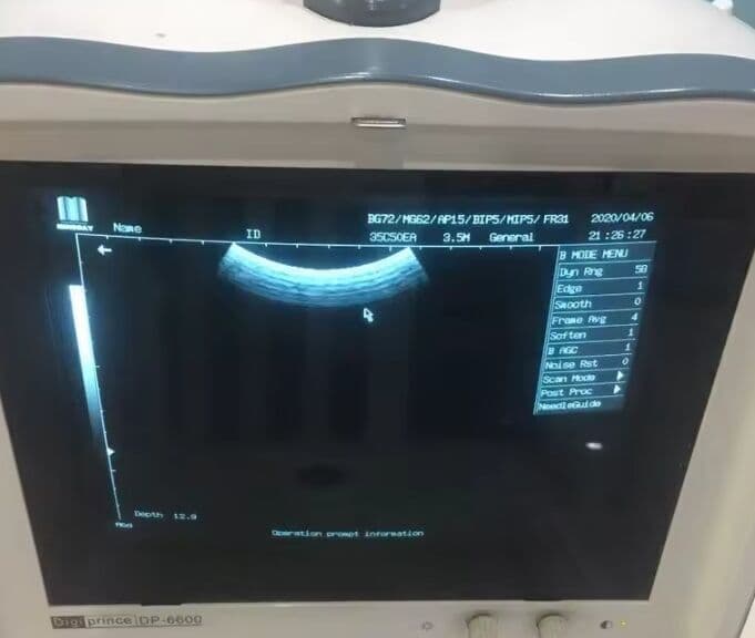 Mindray 35C50EA Ultrasound Transducer thumbnail 3