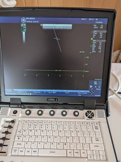 GE 9L-RS Linear Array Ultrasound Transducer thumbnail 10