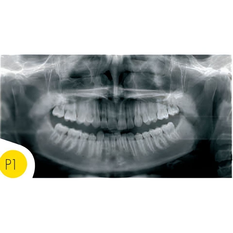 Instrumentarium OP30-2 Pan Digital Panoramic Dental X-Ray thumbnail 2