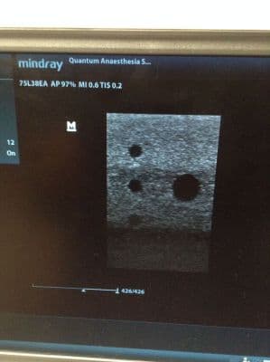 Portable Mindray DP-50 Black and White Ultrasound System thumbnail 2