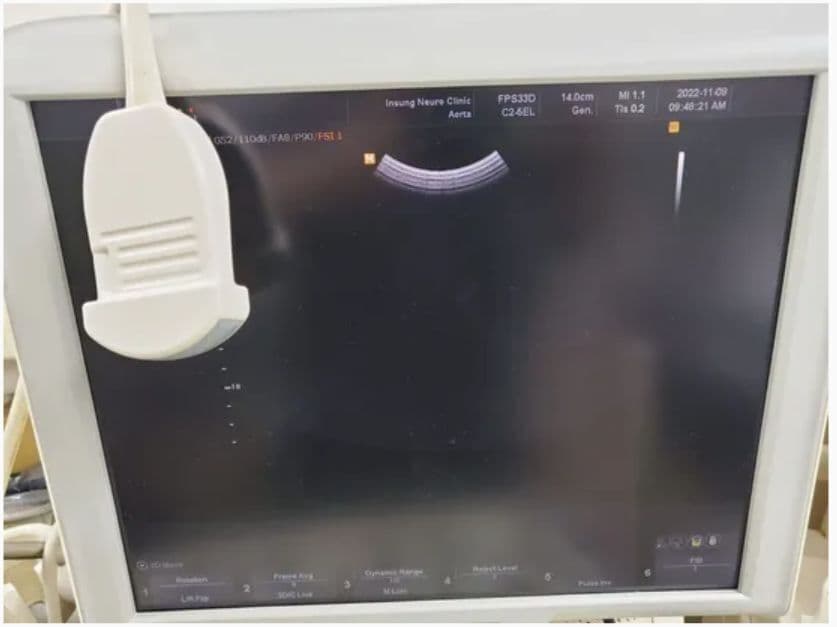 Samsung Medison C2-5EL Convex Ultrasound Transducer image 1