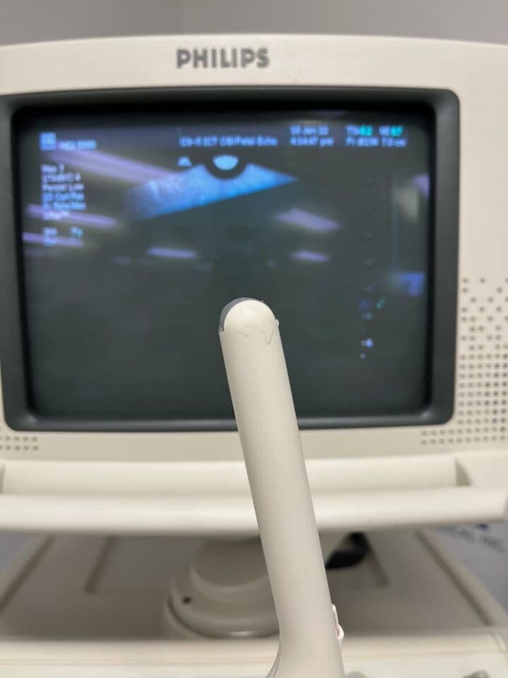 Philips HDI 5000 Ultrasound System with Three Probes thumbnail 6