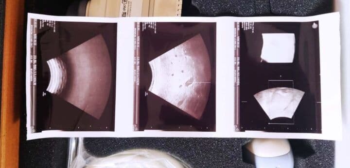 GE RAB6-D 3D/4D Convex Ultrasound Transducer thumbnail 6