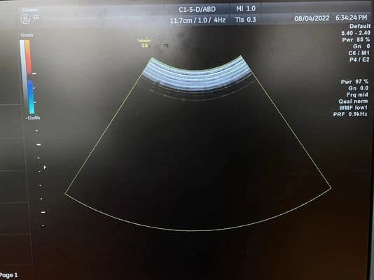 GE Healthcare C1-5-D Convex Array Ultrasound Transducer thumbnail 4