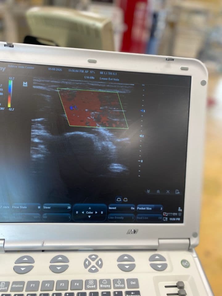 Mindray M7 Vein Ultrasound System with Trolley thumbnail 4